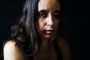 Read more about the article Why Abuse Victims Protect Their Abusers